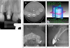 cone beam volumetric tomography