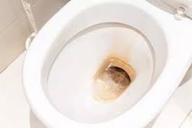 Remove Brown And Yellow Toilet Stains