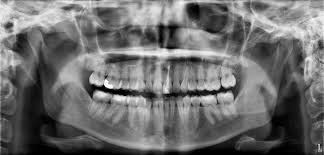 cbct scan cambie marine gateway dental