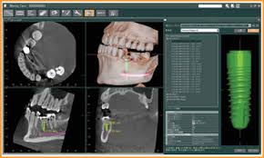 learn more about cone beam ct 3d imaging
