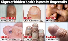 What Do Your Fingernails Say About You