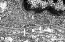 Basement Membranes In The Cornea And