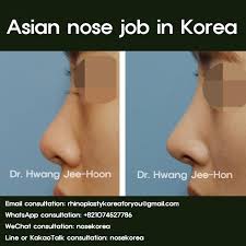 asian nose job in south korea