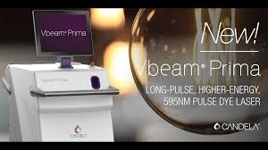 vbeam prima the new age technology