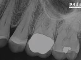 endodontist loves cone beam technology