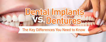 dental implants vs dentures which one