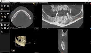 digital x rays in charleston wv