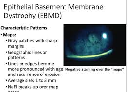 Opt 631 Corneal Dysgeneses Flashcards