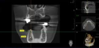 cone beam ct scan smoler smiles