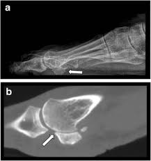 cone beam ct of the musculoskeletal