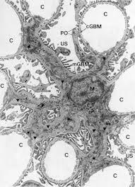 Mesangial Cell An Overview