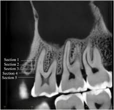 dental cone beam computed tomography