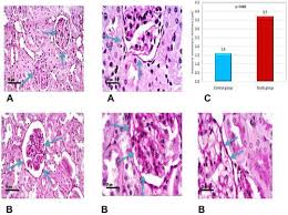 Full Article Cyclophilin A Cypa As A