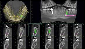 cone beam centre d imagerie médicale