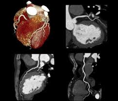 trends in cardiac imaging over past