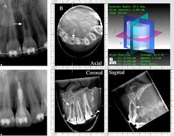 cone beam volumetric tomography