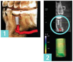 gendex dental systems blog cbct