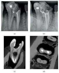 cone beam computed tomography