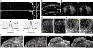 light sheet microscopy