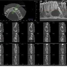 cone beam computed tomography cbct of