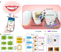 Theranostic Dental Patch