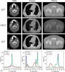 cone beam ct