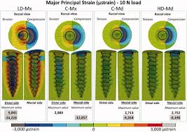 Can Maxilla And Mandible Bone Quality