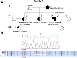 Col4a3 Mutation Identified In Family 2