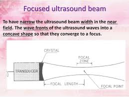 ultrasound powerpoint presentation