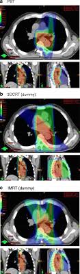 radiation oncology