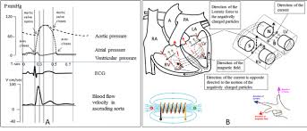 Arterial Blood Flow