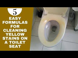 Cleaning Yellow Stains On A Toilet Seat