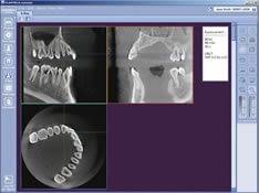 advanced dental imaging charlotte