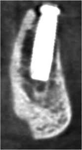 cone beam computed tomography in