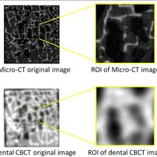 cone beam ct cbct and micro ct