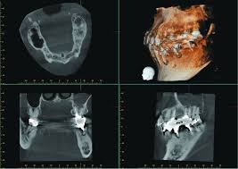 cone beam computed tomography in