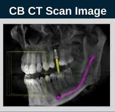 dental cone beam ct scan burbank my