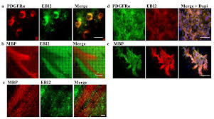 organotypic cerebellar