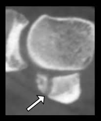 cone beam ct of the musculoskeletal