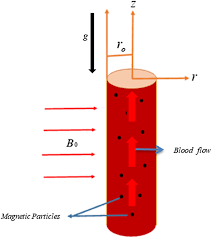 Fractional Model Of Mhd Blood Flow In A