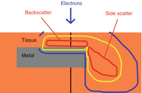 dosimetry of electron beams springerlink