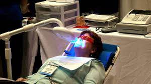 zoom vs laser teeth whitening