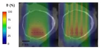 minibeam radiotherapy from photons to