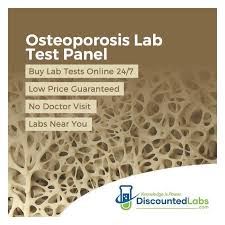 Osteoporosis Lab Test Panel