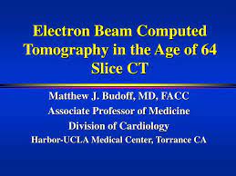 ppt electron beam computed tomography