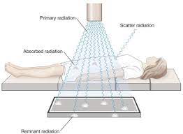 radiographic imaging chapter 7