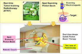 the real time tumor tracking