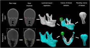 multi slice ct and cone beam ct