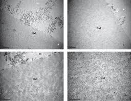 Full Article Exfoliation Fibrils