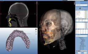 3d scan cbct conebeam diagnose